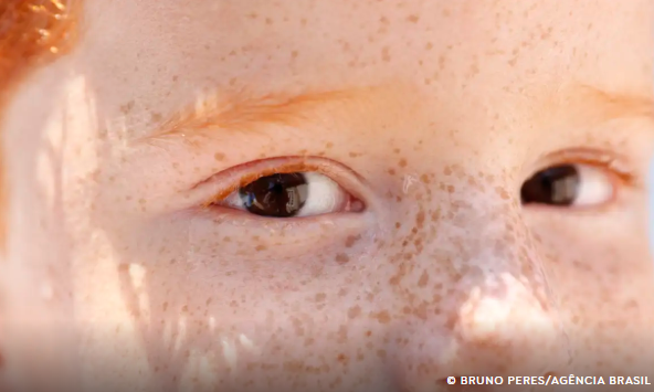 Reflexo branco nos olhos: entenda condição que assusta pais