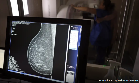 Falta de acesso a mamógrafos limita prevenção do câncer de mama