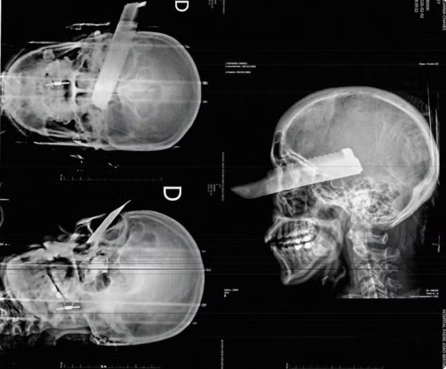 Suspeito de tentativa de feminicídio em São Carlos tem prisão preventiva decretada a pedido do MPSC