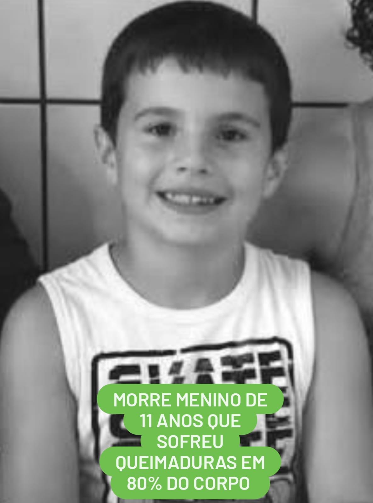 Depois de 23 dias internado no hospital em Florianópolis menino de 11 anos que sofreu queimaduras após explosão em oficina de Chapecó vem a óbito
